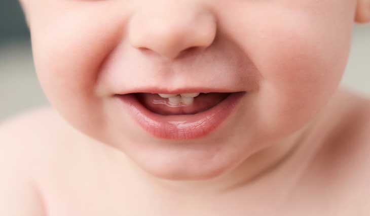 دندان نیش نوزاد