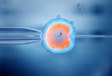 روش ivf