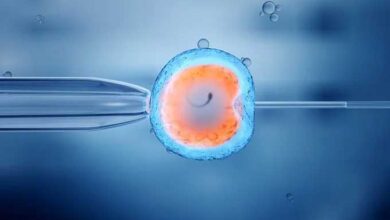روش ivf