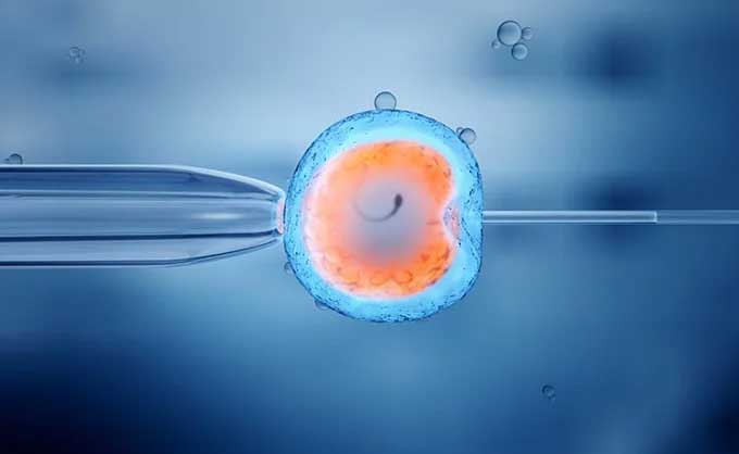 روش ivf