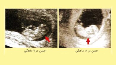 تصویر جنین در هفته 9 و هفته 12 بارداری