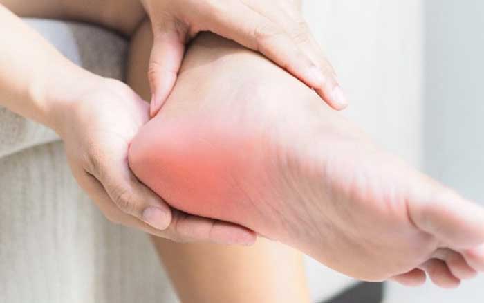 اطلاعات عمومی درمان خار پاشنه با پودر موبر+ با شیشه نوشابه